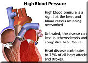 High blood pressure